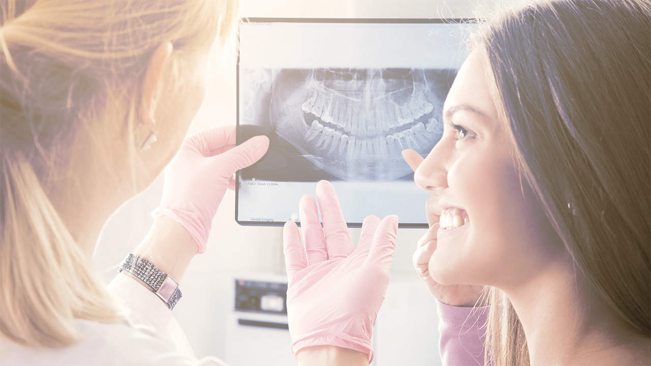 Tooth Implants